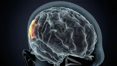 Devi sapere quali conseguenze ha la frequente mancanza di sonno sul tuo cervello